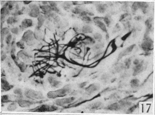 https://cdn.ncbi.nlm.nih.gov/pmc/blobs/e736/1252767/a5aa03cd7133/janat00506-0058-h.jpg
