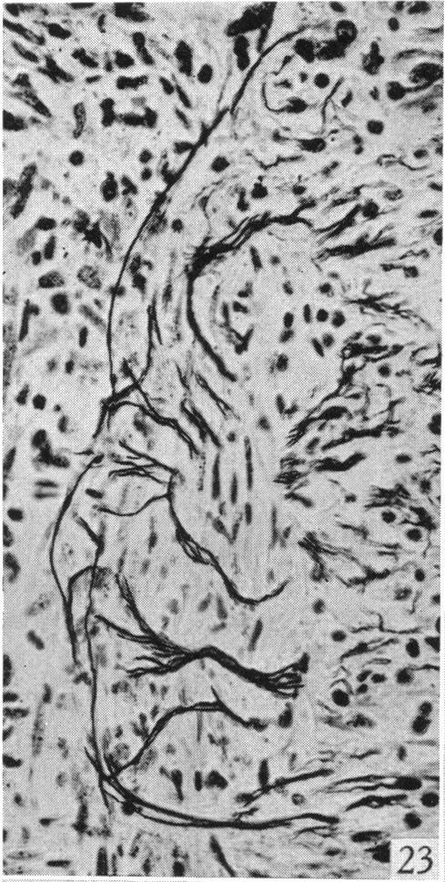 https://cdn.ncbi.nlm.nih.gov/pmc/blobs/e736/1252767/ab3b9c3337f6/janat00506-0059-b.jpg