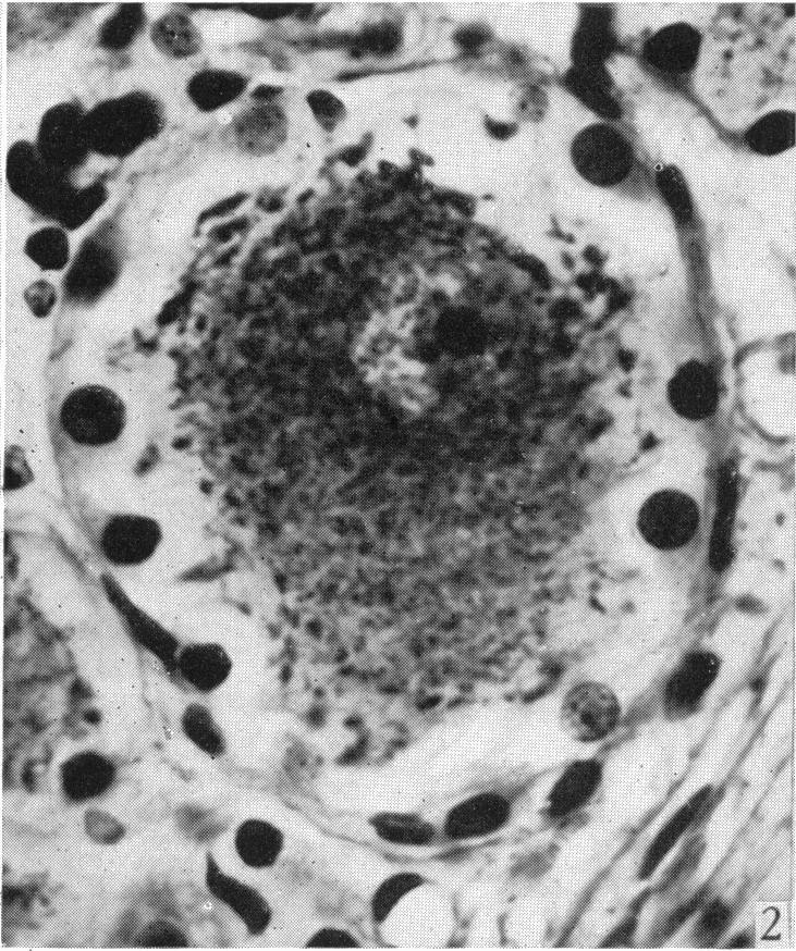 https://cdn.ncbi.nlm.nih.gov/pmc/blobs/e736/1252767/f3dc633e6e10/janat00506-0057-b.jpg
