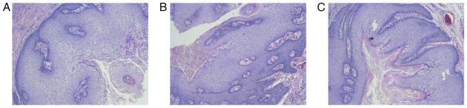 https://cdn.ncbi.nlm.nih.gov/pmc/blobs/e737/9047027/31f02e2dcfac/etm-23-06-11320-g06.jpg