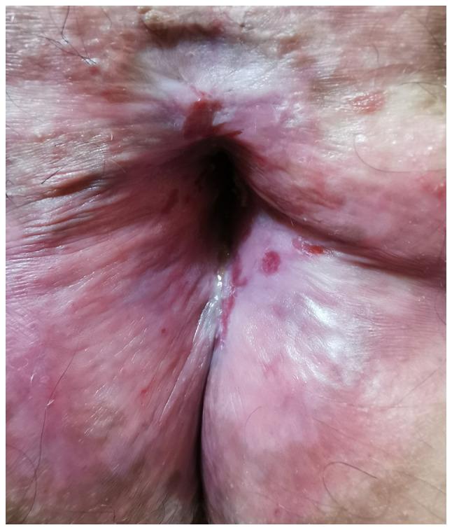 https://cdn.ncbi.nlm.nih.gov/pmc/blobs/e737/9047027/a934ef709ff4/etm-23-06-11320-g05.jpg