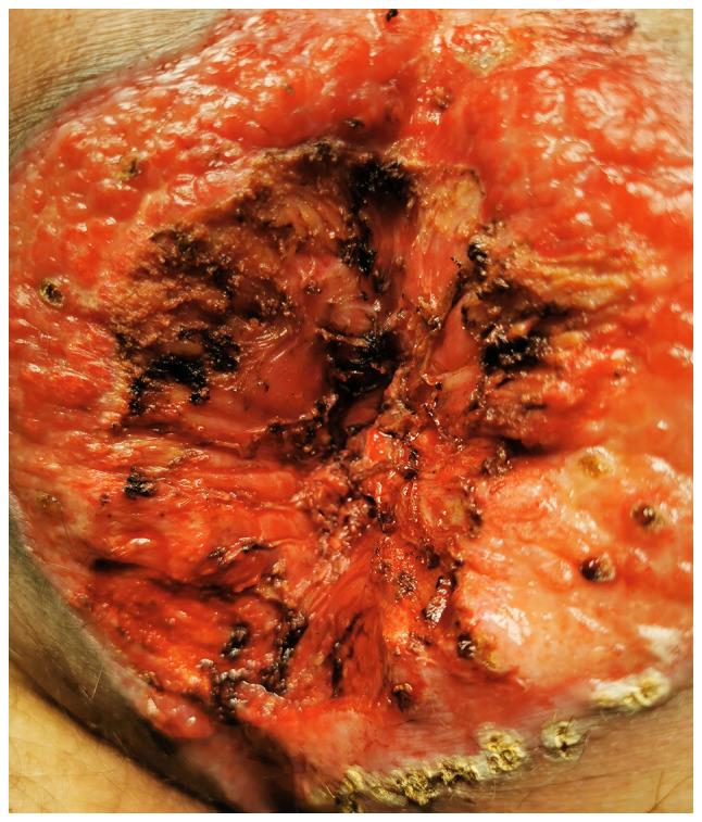 https://cdn.ncbi.nlm.nih.gov/pmc/blobs/e737/9047027/c708580d9cd9/etm-23-06-11320-g04.jpg