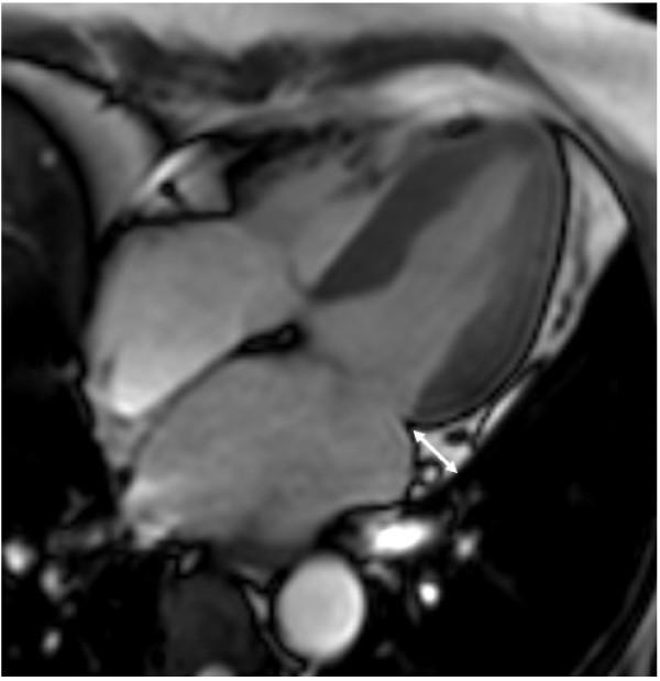 https://cdn.ncbi.nlm.nih.gov/pmc/blobs/e73e/3461492/ba5c094ede9b/1475-2840-11-83-1.jpg