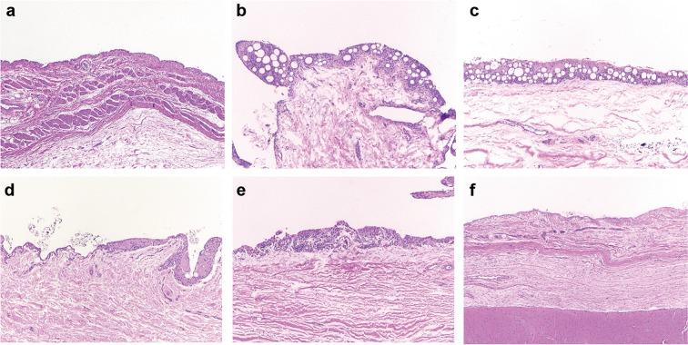 https://cdn.ncbi.nlm.nih.gov/pmc/blobs/e73f/6251841/c710a674a923/40744_2018_125_Fig8_HTML.jpg