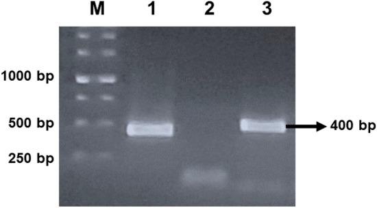 https://cdn.ncbi.nlm.nih.gov/pmc/blobs/e73f/9362449/5348da180591/10930_2022_10066_Fig8_HTML.jpg