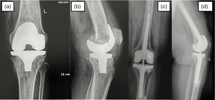 https://cdn.ncbi.nlm.nih.gov/pmc/blobs/e741/11872043/0002fdf62959/cureus-0017-00000078273-i03.jpg