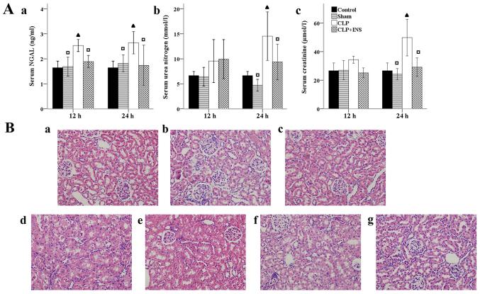 https://cdn.ncbi.nlm.nih.gov/pmc/blobs/e743/5858081/6bcbf053426c/etm-15-04-3967-g00.jpg