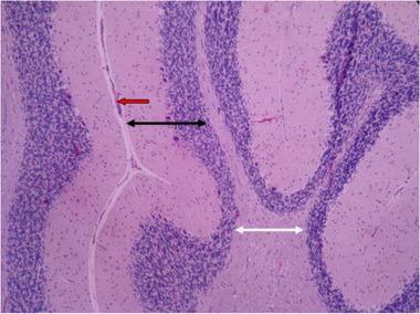 https://cdn.ncbi.nlm.nih.gov/pmc/blobs/e743/8413823/3d309a19181a/BRB3-11-e2319-g014.jpg
