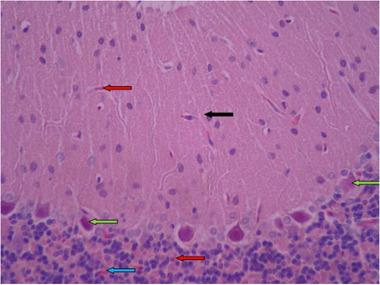 https://cdn.ncbi.nlm.nih.gov/pmc/blobs/e743/8413823/84924657b4a2/BRB3-11-e2319-g003.jpg
