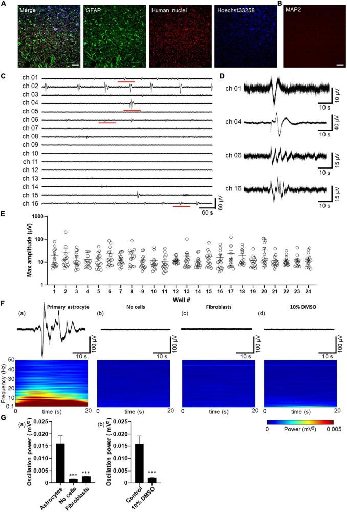 https://cdn.ncbi.nlm.nih.gov/pmc/blobs/e745/9872017/b4c2e5f410ae/fnins-16-1050150-g001.jpg