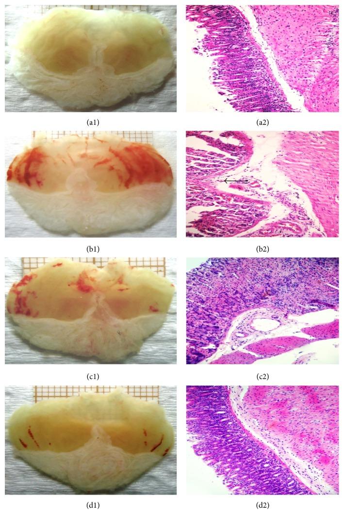 https://cdn.ncbi.nlm.nih.gov/pmc/blobs/e749/4691623/3ae70b598a50/ECAM2015-706782.002.jpg
