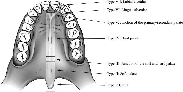 https://cdn.ncbi.nlm.nih.gov/pmc/blobs/e74c/9585542/fc54b294cb5e/10.1177_10556656211055641-fig1.jpg