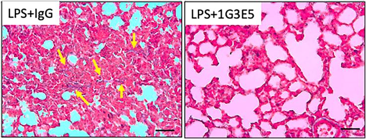 https://cdn.ncbi.nlm.nih.gov/pmc/blobs/e74d/9682349/e7a3473c382b/gr7.jpg