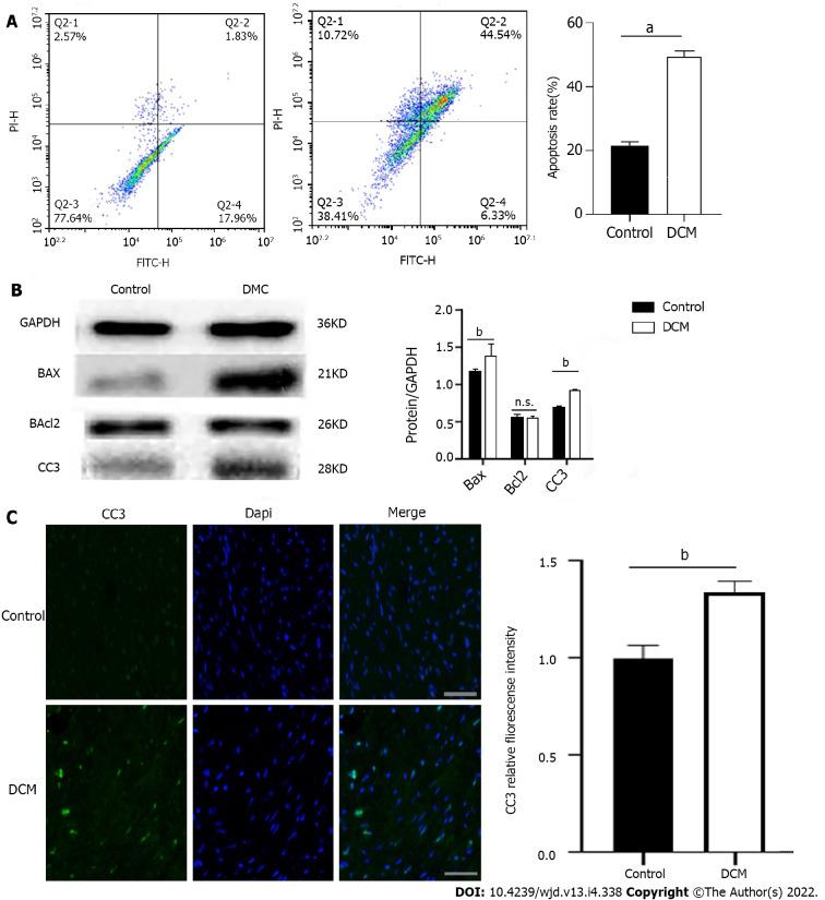 https://cdn.ncbi.nlm.nih.gov/pmc/blobs/e750/9052005/9a76e60023d2/WJD-13-338-g002.jpg