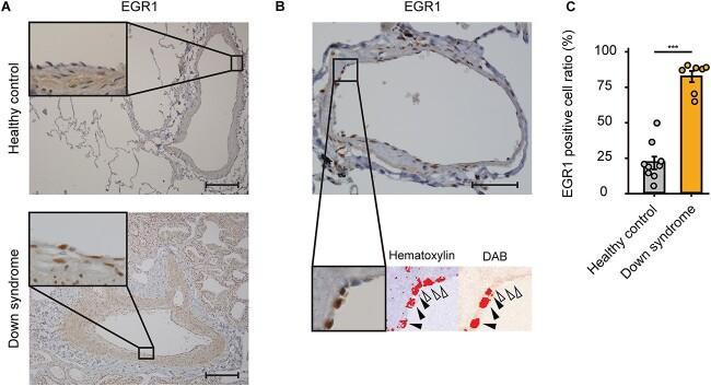 https://cdn.ncbi.nlm.nih.gov/pmc/blobs/e751/10729858/fce52e7108b3/ddad162f7.jpg