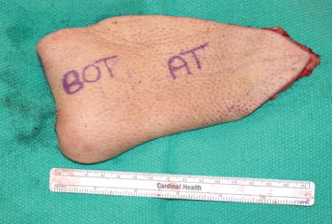 https://cdn.ncbi.nlm.nih.gov/pmc/blobs/e754/7585251/650b05c9323b/LIO2-5-853-g003.jpg