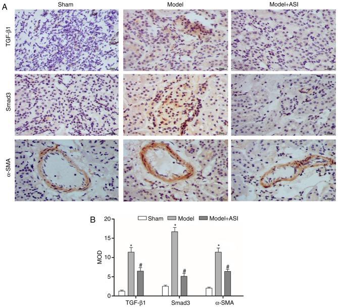 https://cdn.ncbi.nlm.nih.gov/pmc/blobs/e75a/6755437/06f2b73ea185/etm-18-04-3053-g04.jpg