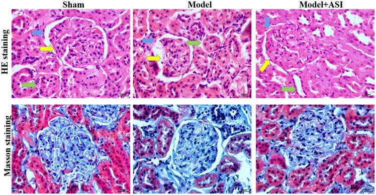https://cdn.ncbi.nlm.nih.gov/pmc/blobs/e75a/6755437/0a6fb3170706/etm-18-04-3053-g02.jpg