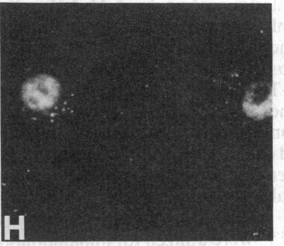 https://cdn.ncbi.nlm.nih.gov/pmc/blobs/e767/391252/7351b83cd52a/pnas00359-0221-h.jpg