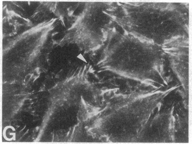 https://cdn.ncbi.nlm.nih.gov/pmc/blobs/e767/391252/8300617ae5a0/pnas00359-0220-g.jpg