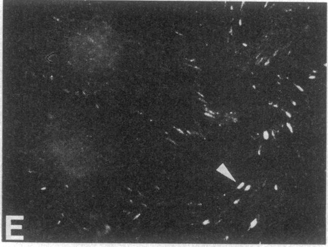 https://cdn.ncbi.nlm.nih.gov/pmc/blobs/e767/391252/cdf1297389da/pnas00359-0220-f.jpg