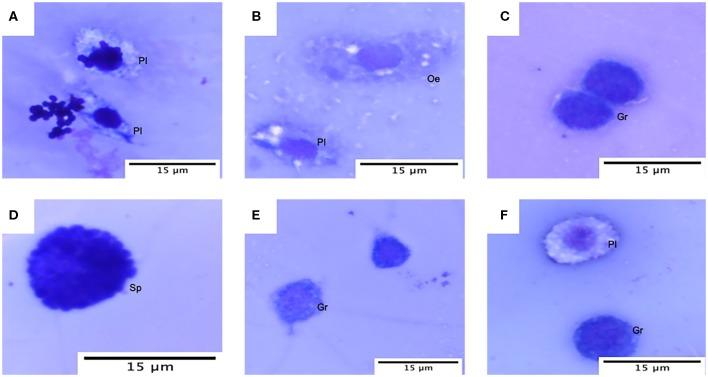 https://cdn.ncbi.nlm.nih.gov/pmc/blobs/e769/7214729/480beef04bf5/fcimb-10-00199-g0004.jpg
