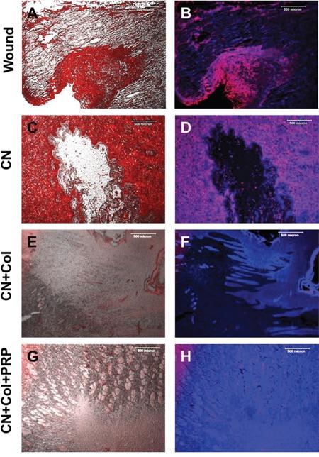 https://cdn.ncbi.nlm.nih.gov/pmc/blobs/e76a/5421924/11b17821083f/oncotarget-08-25226-g009.jpg