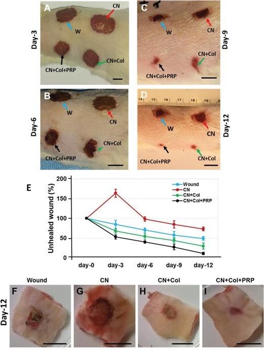 https://cdn.ncbi.nlm.nih.gov/pmc/blobs/e76a/5421924/86a52585cc12/oncotarget-08-25226-g004.jpg