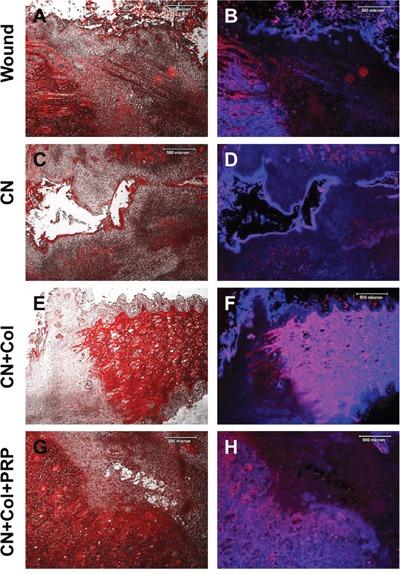https://cdn.ncbi.nlm.nih.gov/pmc/blobs/e76a/5421924/8da53b5a0792/oncotarget-08-25226-g008.jpg