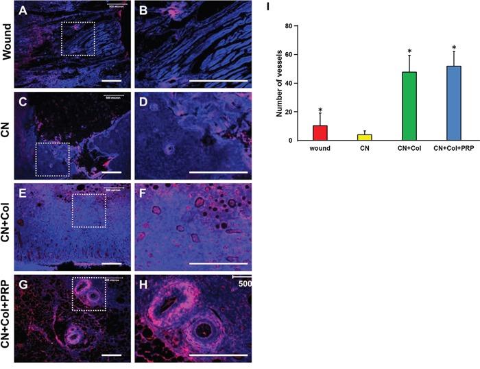 https://cdn.ncbi.nlm.nih.gov/pmc/blobs/e76a/5421924/94fc6a9e4250/oncotarget-08-25226-g010.jpg