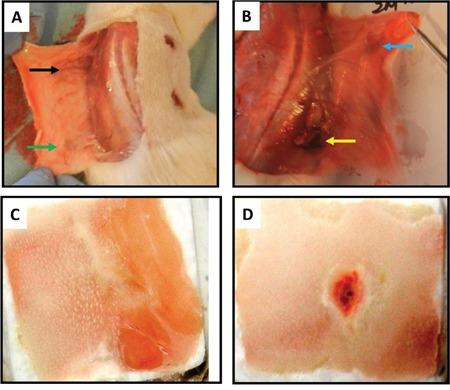 https://cdn.ncbi.nlm.nih.gov/pmc/blobs/e76a/5421924/a5a5d011f7f1/oncotarget-08-25226-g005.jpg
