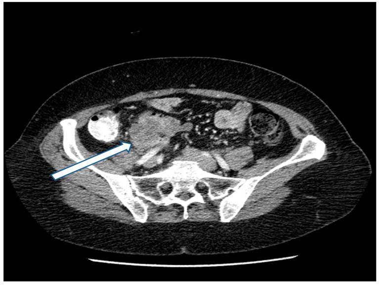 https://cdn.ncbi.nlm.nih.gov/pmc/blobs/e770/11051342/908e233f6a35/jcm-13-02238-g001.jpg