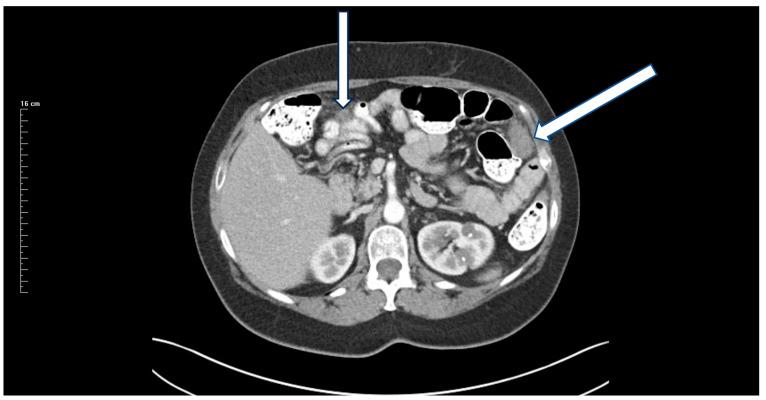 https://cdn.ncbi.nlm.nih.gov/pmc/blobs/e770/11051342/d2273cfe5548/jcm-13-02238-g002.jpg