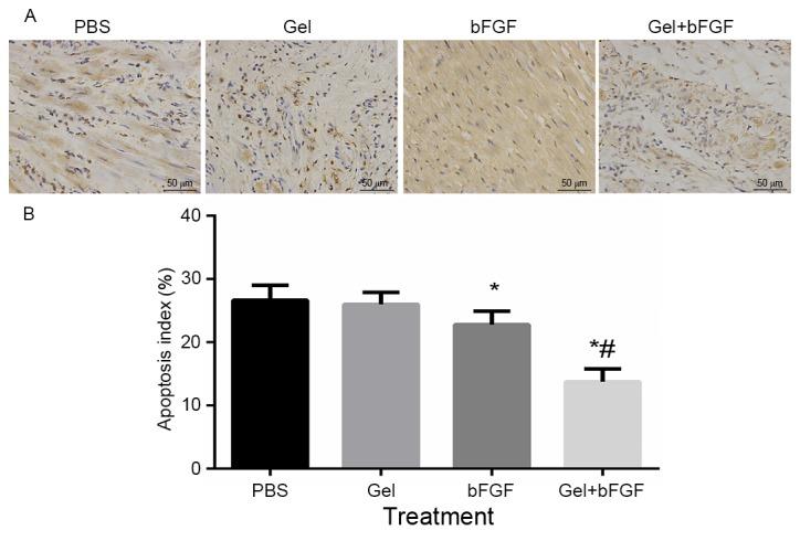 https://cdn.ncbi.nlm.nih.gov/pmc/blobs/e775/5639332/15fdfda6f867/etm-14-04-3609-g04.jpg