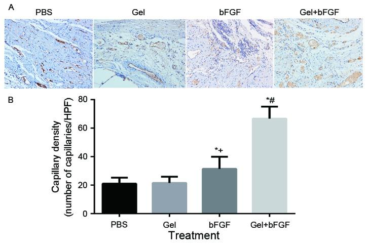 https://cdn.ncbi.nlm.nih.gov/pmc/blobs/e775/5639332/9f5768c50ea5/etm-14-04-3609-g06.jpg
