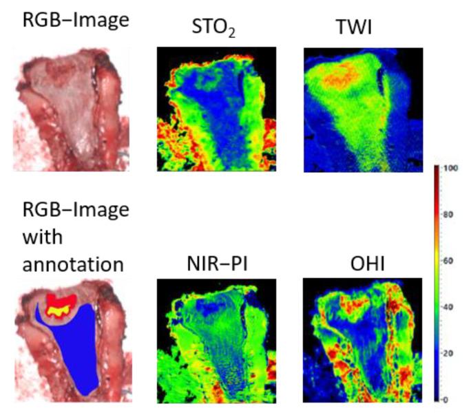 https://cdn.ncbi.nlm.nih.gov/pmc/blobs/e779/7956537/16e475cd7353/cancers-13-00967-g005.jpg
