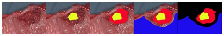 https://cdn.ncbi.nlm.nih.gov/pmc/blobs/e779/7956537/22e1e829ce55/cancers-13-00967-g001.jpg