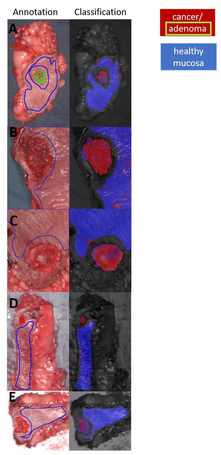 https://cdn.ncbi.nlm.nih.gov/pmc/blobs/e779/7956537/6c9129fdd750/cancers-13-00967-g003.jpg