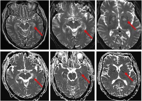 https://cdn.ncbi.nlm.nih.gov/pmc/blobs/e77c/5390465/86ae3d779744/13054_2017_1670_Fig2_HTML.jpg