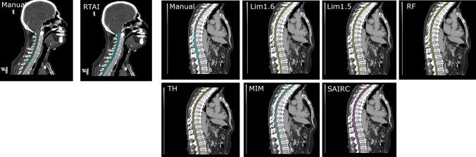 https://cdn.ncbi.nlm.nih.gov/pmc/blobs/e784/11408550/1d7b0fe49376/13246_2024_1434_Fig1_HTML.jpg