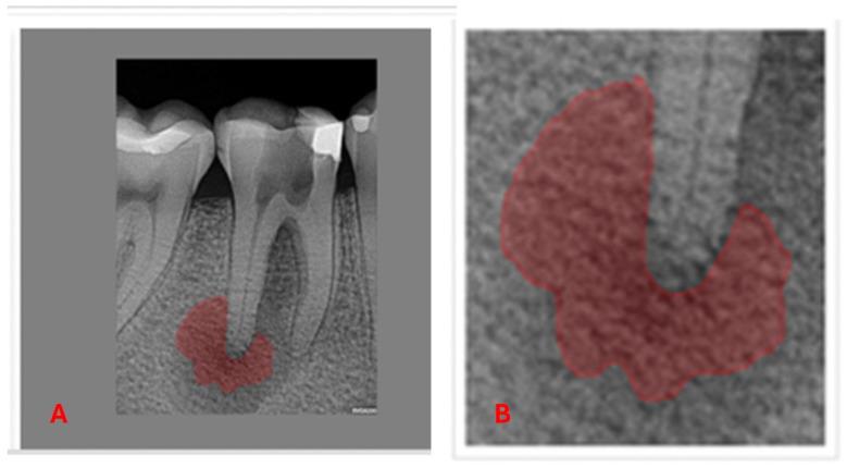 https://cdn.ncbi.nlm.nih.gov/pmc/blobs/e785/12025965/f20d0594be10/diagnostics-15-01009-g003.jpg