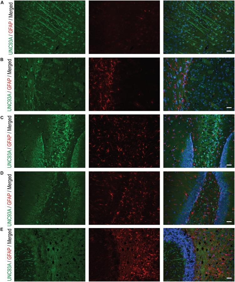 https://cdn.ncbi.nlm.nih.gov/pmc/blobs/e787/5671512/8390f6c392c1/fnmol-10-00351-g006.jpg