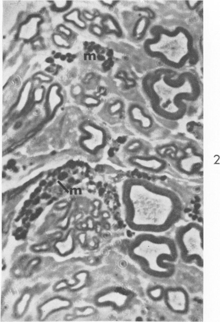 https://cdn.ncbi.nlm.nih.gov/pmc/blobs/e78b/1907193/70fb72be6185/amjpathol00299-0189-b.jpg