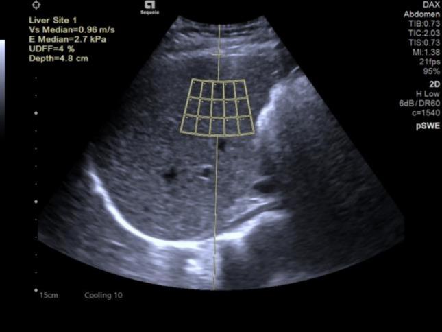 https://cdn.ncbi.nlm.nih.gov/pmc/blobs/e78d/12041043/ba0869a9df69/10238_2025_1635_Fig1_HTML.jpg