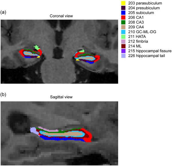 https://cdn.ncbi.nlm.nih.gov/pmc/blobs/e790/11319231/24b1255c5ceb/BRB3-14-e3645-g003.jpg