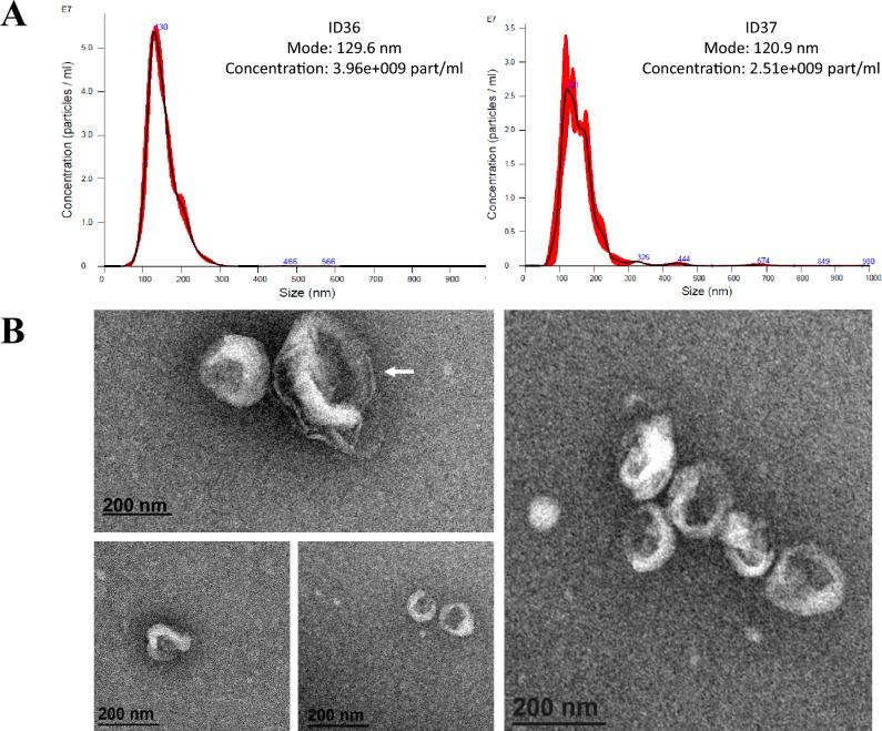 https://cdn.ncbi.nlm.nih.gov/pmc/blobs/e791/11102540/3318a404190c/41598_2024_62061_Fig2_HTML.jpg