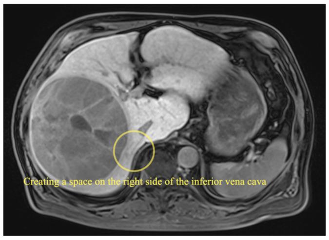 https://cdn.ncbi.nlm.nih.gov/pmc/blobs/e791/9689527/abd74fca63fe/curroncol-29-00652-g002.jpg