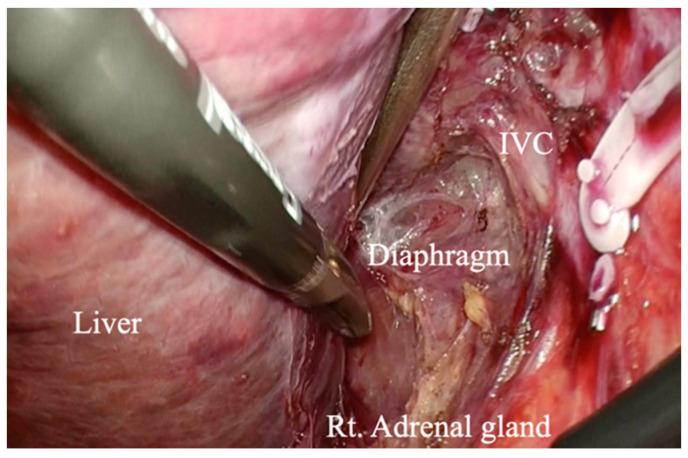 https://cdn.ncbi.nlm.nih.gov/pmc/blobs/e791/9689527/abfa7d2dc0b7/curroncol-29-00652-g003.jpg