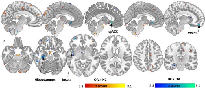 https://cdn.ncbi.nlm.nih.gov/pmc/blobs/e794/10108119/79032ef3325f/EJN-57-373-g001.jpg