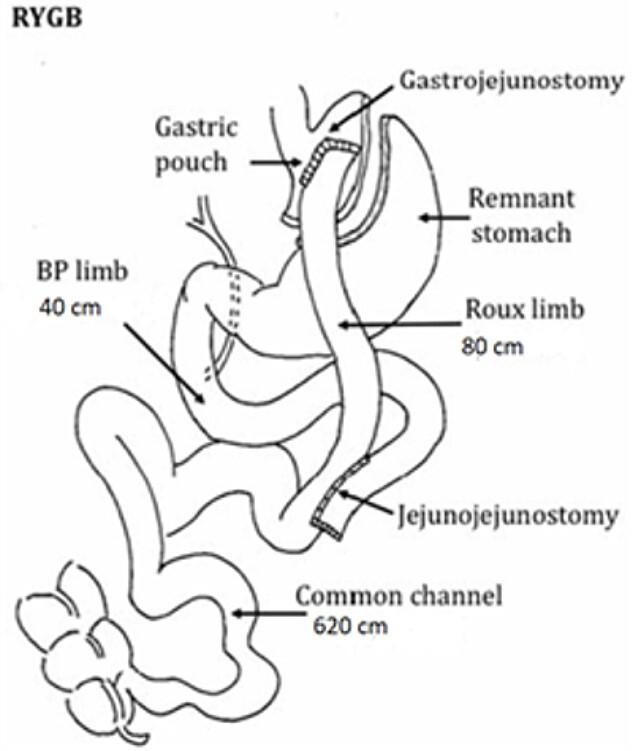 https://cdn.ncbi.nlm.nih.gov/pmc/blobs/e794/9110016/05b712449431/rjac177f1.jpg